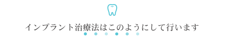 インプラント治療法はこのようにして行います