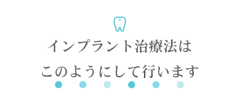 インプラント治療法はこのようにして行います